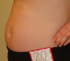 Живот на 20-ой неделе беременности